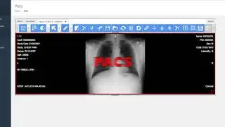 Pegasus medical HIS
