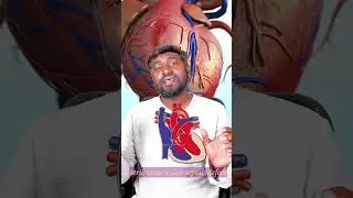 Down Syndrome | Internal Medicine |  FMGE | Dr. Auroraj  #fmge2024 #neet #fmgeians #downsyndrome