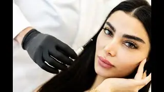 Biostimulators for Natural Facial Rejuvenation