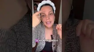 Es como el Botox pero barato: Argireline
