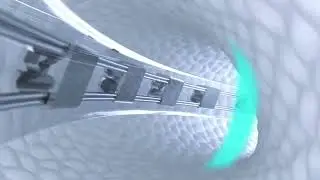 Cómo funciona un implante coclear de Advanced Bionics