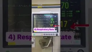 Basic to reading a patient's Monitor 🎞️ (ICCU)