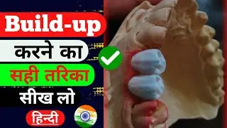 Upper Two Units Layering| Build up video| Metal Ceramic| Layering| Ceramics| Fix Dant| Lab Work's