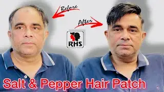 Salt and Pepper Hair Patch | Hair Transformation | Hair Patches For Men | Black & White Hair Patch.