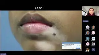 Dermatologic Manifestations in Children with Skin of Color   Pediatric Grand Rounds 1-16-2026
