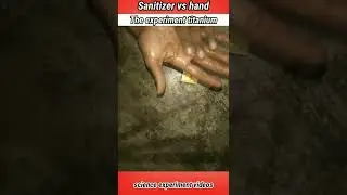 Experiment : Sanitizer vs Hand fire || It's Dengerous   - #shorts #trending #viral
