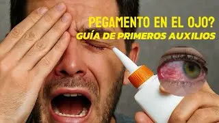 TE ENTRO PEGAMENTO EN LOS OJOS? 😱🤯TE EXPLICO QUE ES LO QUE TENES QUE HACER ! 