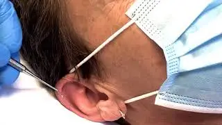 Jane feels anxious, so Merry suggests auricular therapy for self soothing. Fancy!