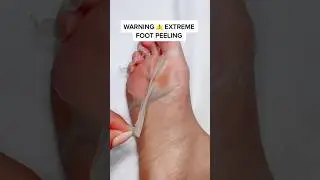Best Foot Peel Mask | Foot Care | Baby Soft Feet | Skincare Tips & Tricks | Get Rid of Dry Feet