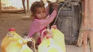 Yemen is Starving!