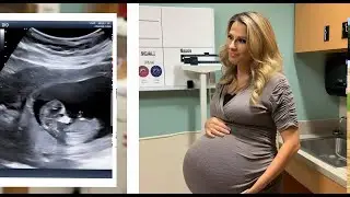 Girl sees the doctor he calls the cops after seeing the ultrasound
