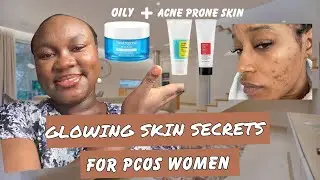 Conquer Oily, Acne-Prone Skin | The Ultimate PCOS Skincare Routine💫 #PCOSSkinCare