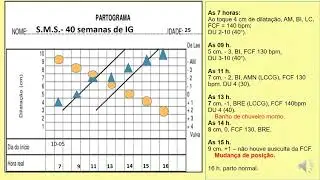 O partograma - vamos preencher um partograma. #exerciciospartograma.