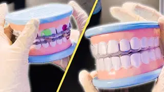 ASMR | DENTIST DEEP CLEANING | Melissa And Doug Dentist Kit