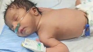 8 Newborn Babies in NICU | Different Diagnoses & Care | Neonatal Observation 🍼