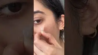 Это мой любимый пластырь от прыщей.