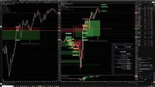🔥 LIVE Day Trading NASDAQ, GOLD & ES &mdash; STS4x Blueprint for Consistent Traders 🔥