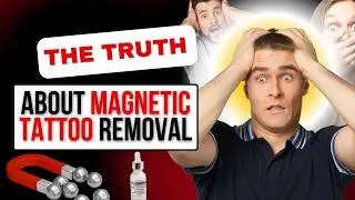 Magnetic Tattoo Removal Review: FDA-Regulated, Patented & Laser-Free | The Truth (2025)