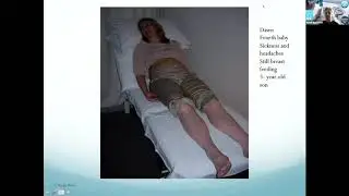 Acupuncture and Acupressure for pregnancy, childbirth and the post natal period