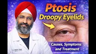 Ptosis : Droopy Eyelids  Causes, Symptoms and Treatment | Ptosis Surgery | Drooping Eyelid Treatment
