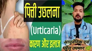 Why does Urticaria keep recurring? The real cause and the right treatment explained #urticaria #a...