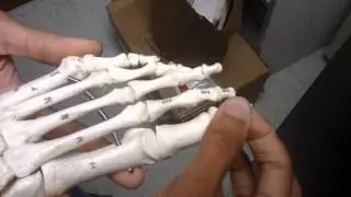 Bones of Foot