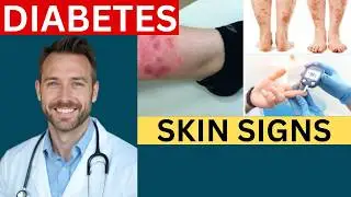 Diabetes Skin Signs: Early Warning Symptoms You Shouldn't Ignore