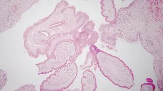 Quiz 11 - Tropical Pathology