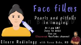 Imaging face fillers pearls and pitfalls
