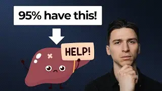 Do you have a sluggish liver?