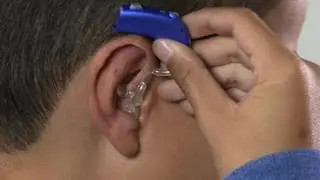 How to place Oticon Sensei BTE hearing aid with mould