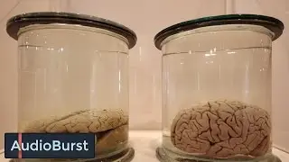Real Or Myth? We Only Use 10 Percent Of Our Brain
