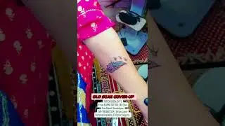 OLD SCAR COVER-UP (50% OFF) (M) -7653822104, Tattoo Laser Remove Available, SAMBALPUR