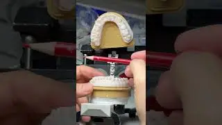 Starting new full mouth case!