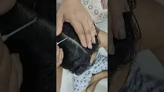 ASMR scalp check & Nitpicking with nails relaxing video #asmr #shorts #shortvideo #hair #skincare