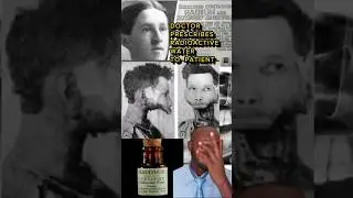 DOCTOR PRESCRIBES RADIOACTIVE WATER TO PATIENT ☢️💀 #radiation