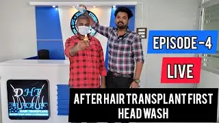 Episode -4 Live After Hair Transplant First Headwash | FUE Tamil Hair Transplant | Tamilan HT