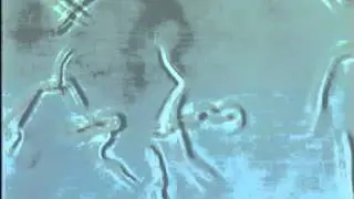 Microfilariae of Loa loa parasites