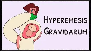 Hyperemesis Gravidarum Explained