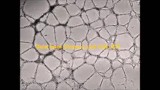 HUVEC cells forming network