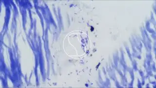 Helicobacter pylori under the microscope with Toluidine Blue stain