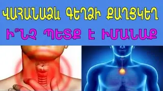 Վահանաձև գեղձի քաղցկեղ, ի՞նչ պետք է իմանաք