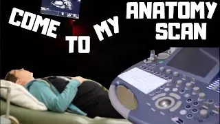 20 WEEK ULTRASOUND - ANATOMY SCAN - WHAT TO EXPECT