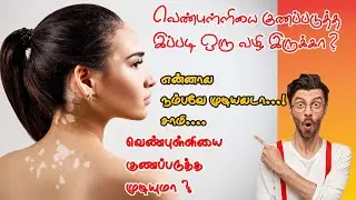 vitiligo treatment |vitiligo skin matching treatment |vitiligo coverup skin |vitiligo coverup tattoo