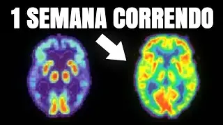 Como Funciona o Cérebro de quem Corre Todos os Dias?