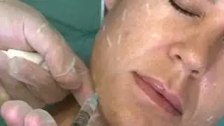 Dr Sebagh on SILHOUETTE SOFT
