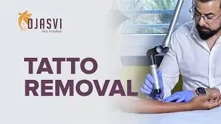 Safe & Effective Tattoo Removal &ndash; Dr. Tavi at Ojasvi Skin Clinic, Meerut