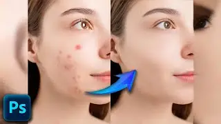 How To Remove Pimples In Photoshop