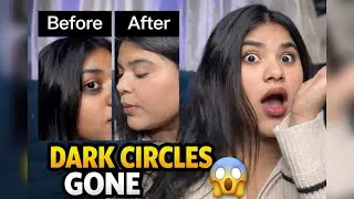 How to remove dark circles instantly | Dark Circles Makeup| Remove Dark Spots Instantly #makeup 