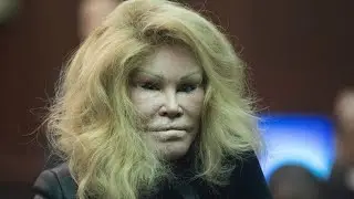 Socialite Jocelyn Wildenstein&rsquo;s Cause of Death Exposed